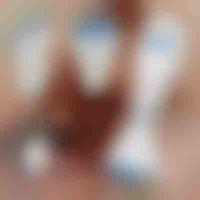 Peine eléctrico para eliminar piojos | TREVY