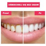 TOOTHCLEANSO